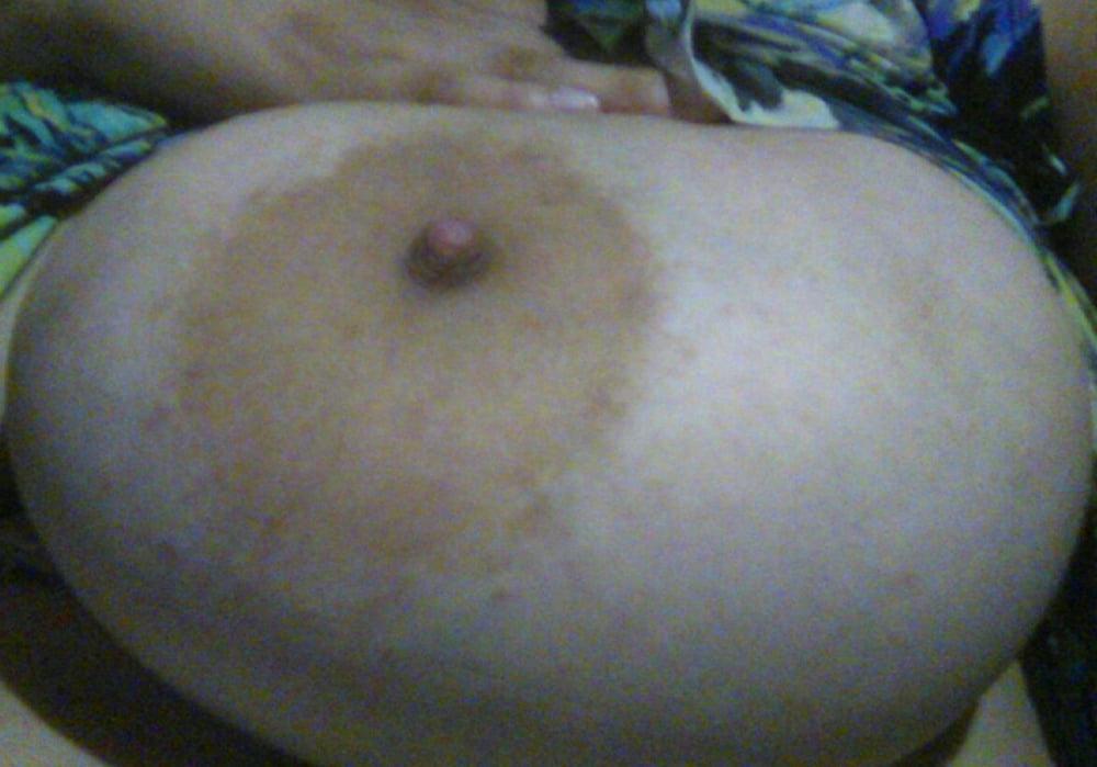 25P Retarded ugly Girl Huge tits