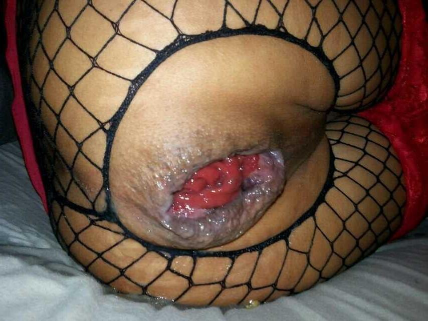25P Huge gaping pussy