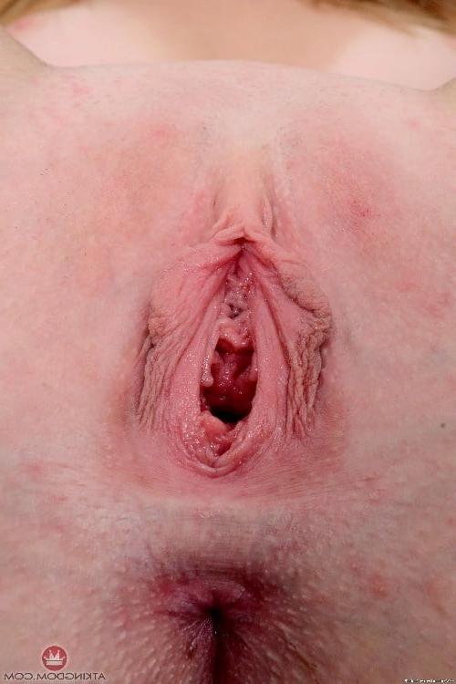 25P Gape 5