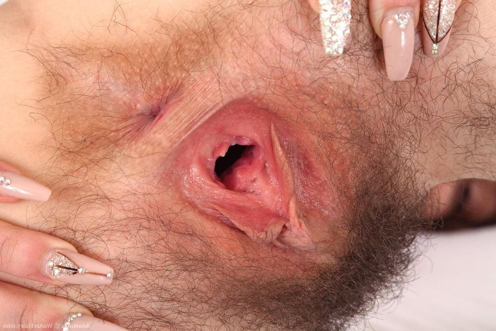 25P Gape 5
