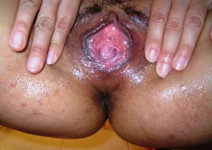25P Gape 5